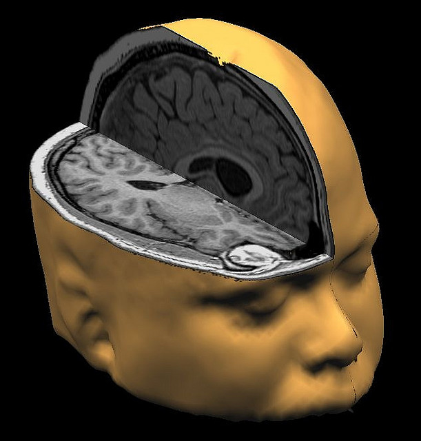 Cross section of child's brain