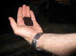 Man Holding a Gallstone